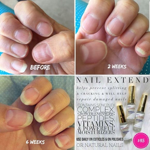 NailExtend - Picture 2 of 2
